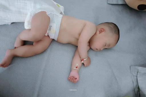 辽阳宝宝头上长痱子